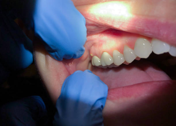 Best Emergency Dentist for Special Needs Patients in Woodmoor, CO